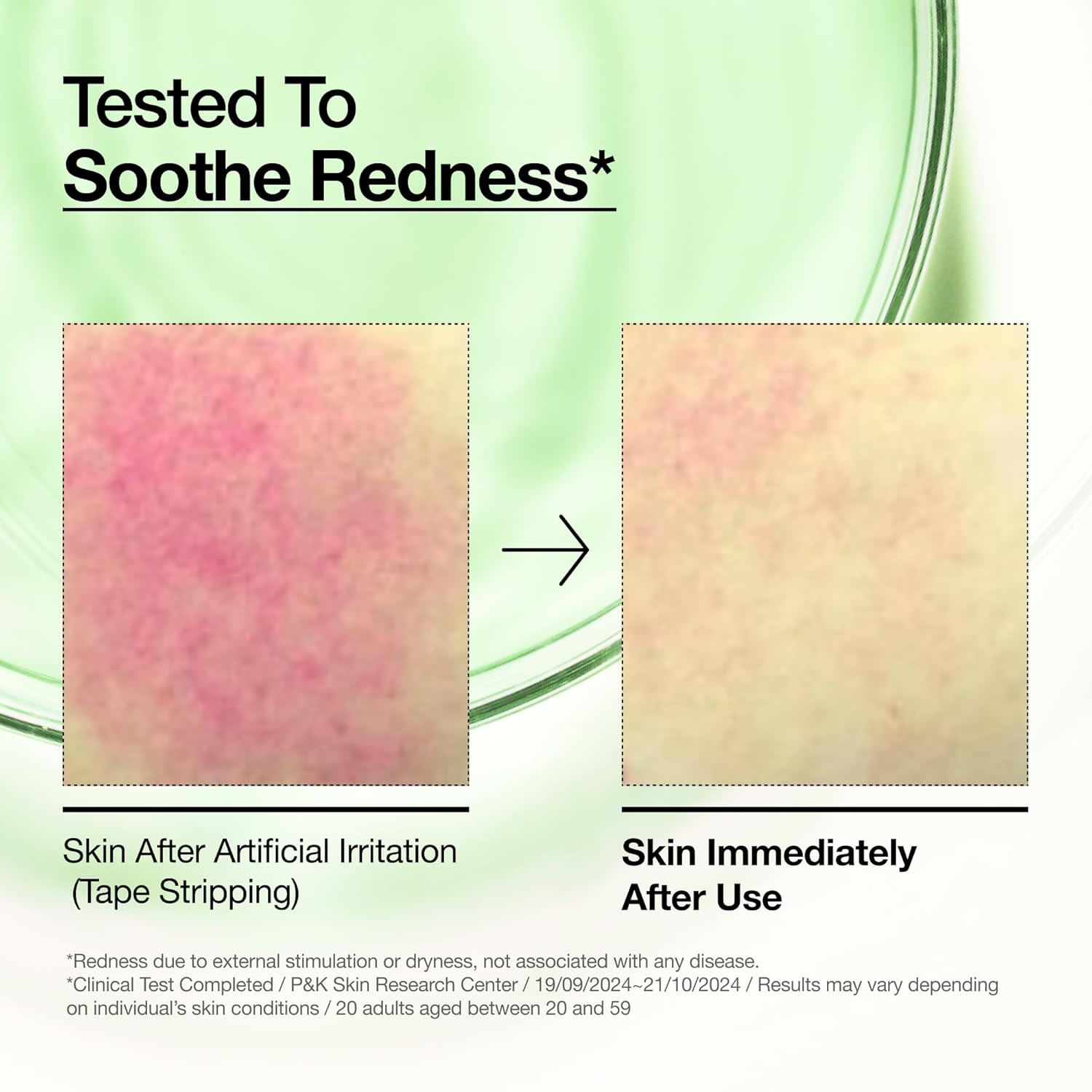 Anua Azelaic Acid 10