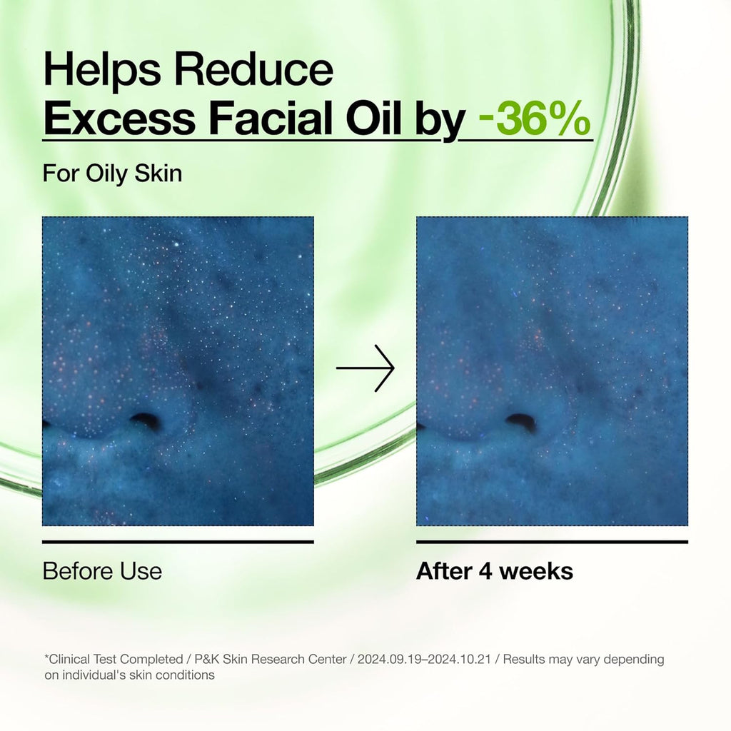 Anua Azelaic Acid 10