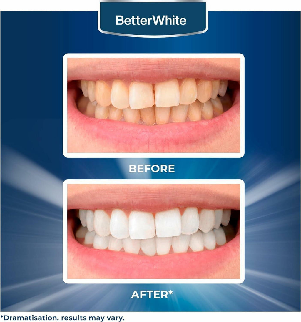 BetterWhite Teeth Whitening Strips